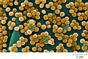 Photo of Staphylococcus auerus