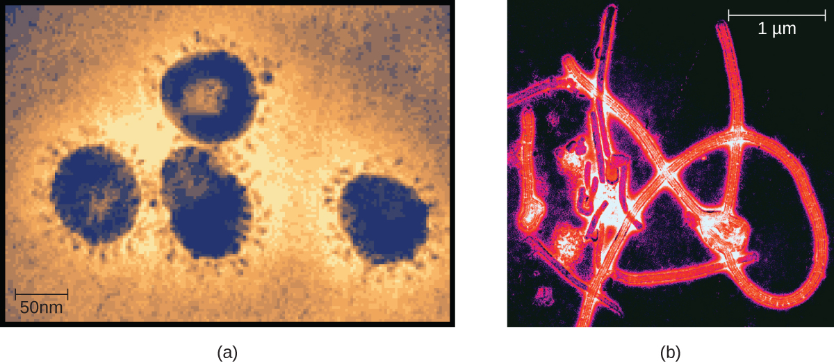 Photos of viruses. The first photo shows members of the Coronavirus family. The second photo shows the Ebolavirus, a member of the Filovirus family.