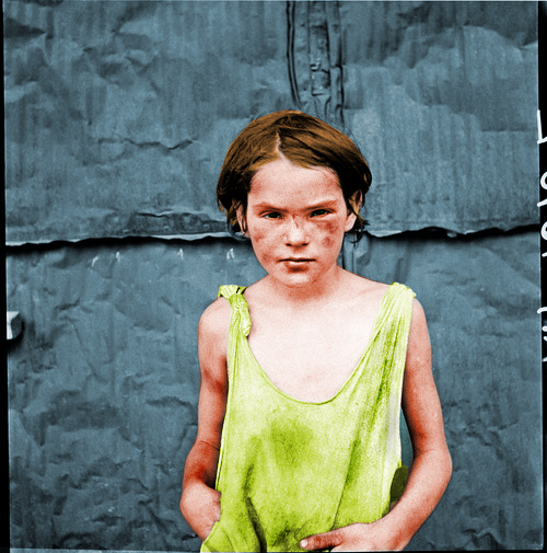 Poverty: "Damaged Child" Oklahoma City, OK USA, 1936 (Colorized)