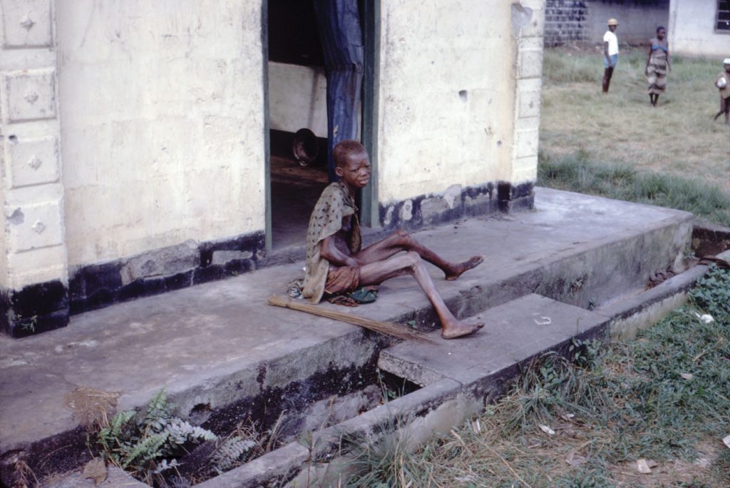 A very malnourished child sitting on a sidewalk. Bones are clearly visible under the skin.