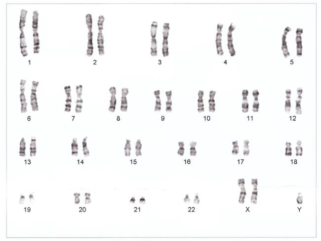 The 23 pairs of chromosomes