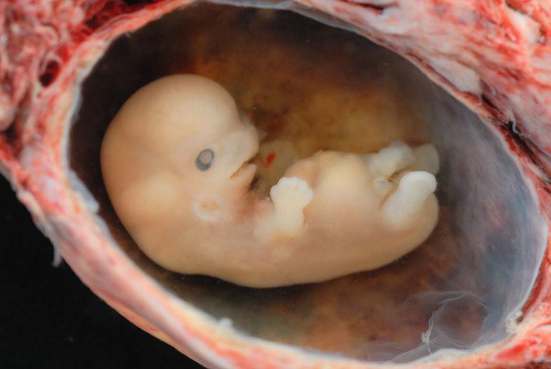 A tiny embryo depicting some development of arms and legs, as well as facial features that are starting to show.
