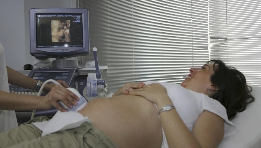 A woman receiving an ultrasound.