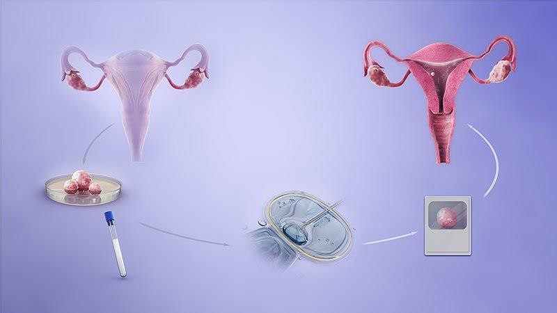 The IVF process