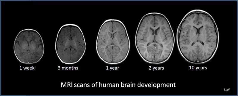 MRI scans of the human brain.