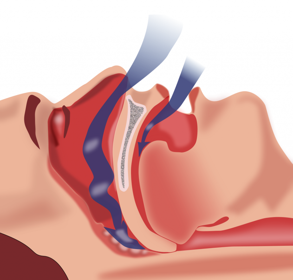 Which cognitive changes are characteristic of a patient experiencing hypoxia select all that apply