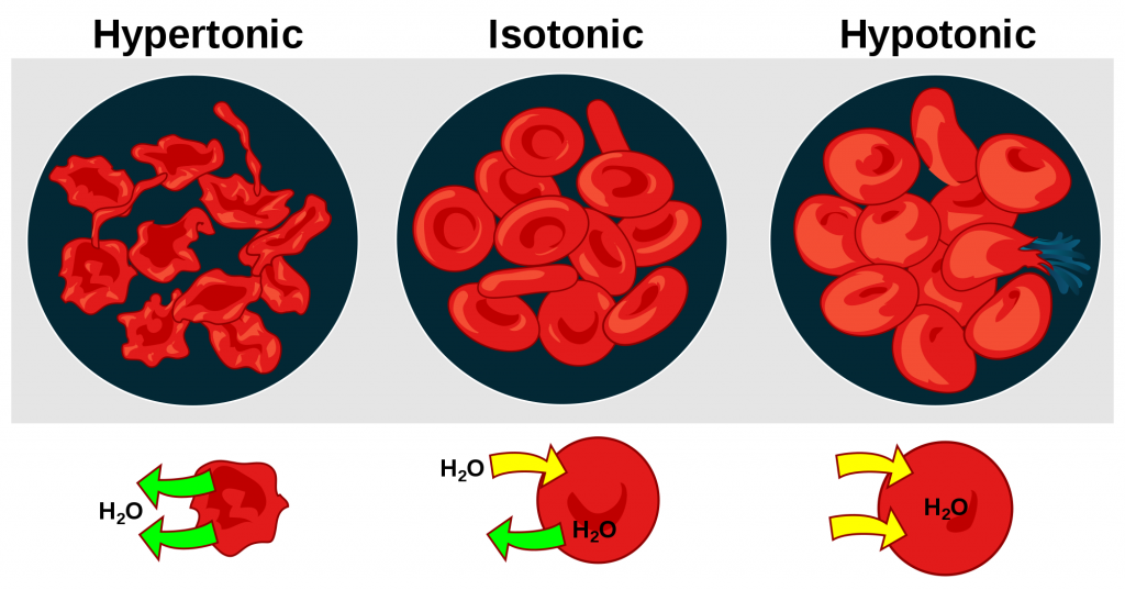 Illustration showing Osmotic Effects of Hypertonic, Isotonic, and Hypotonic IV Fluids on Red Blood Cells