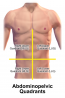 12.3 Gastrointestinal and Genitourinary Assessment – Nursing Skills – 2e