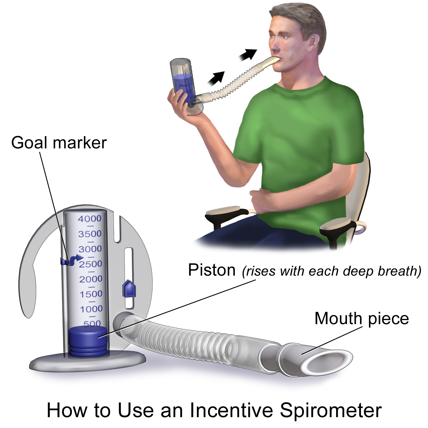 Incentive_Spirometer-1.png