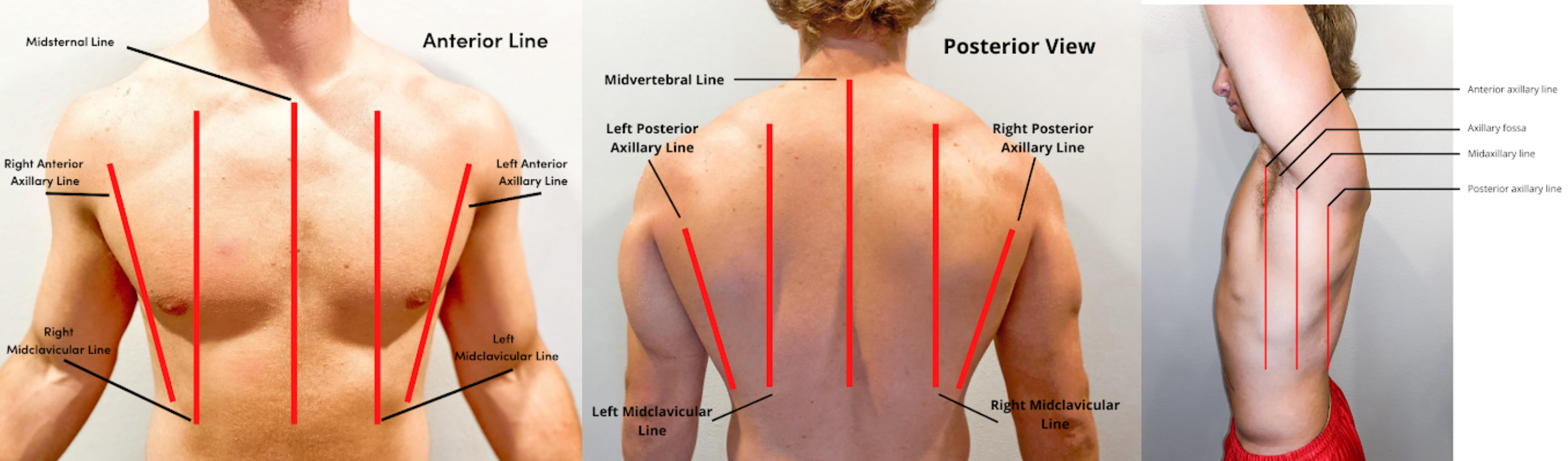 Photo showing Landmarks of the Anterior, Posterior, and Lateral Thorax on human male