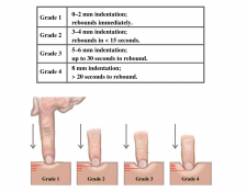 9.3 Cardiovascular Assessment – Nursing Skills – 2e