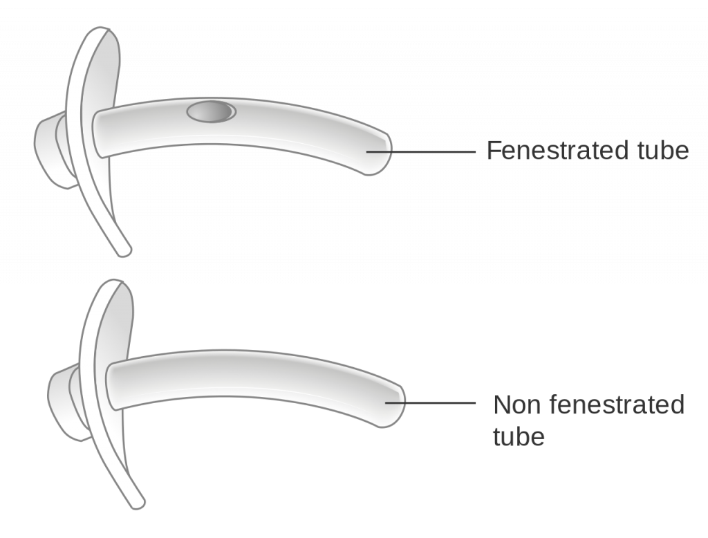 Illustration showing Fenestrated and Non-fenestrated Outer Cannula, with labels