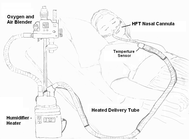 Illustration showing a high flow nasal cannula system, with labels