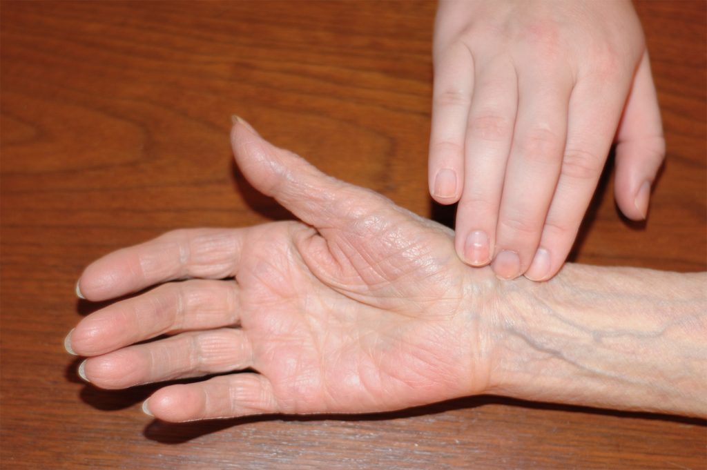 Image showing hand placed on wrist to check radial pulse
