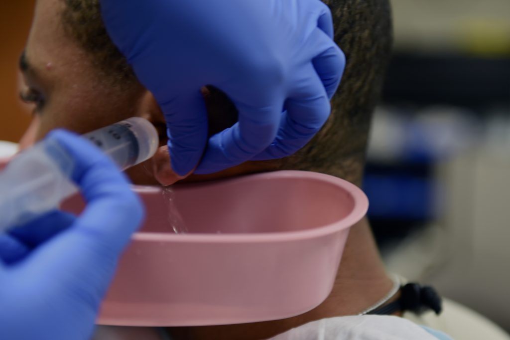 Photo of person having ear canal irrigated with liquid to help remove cerumen build up