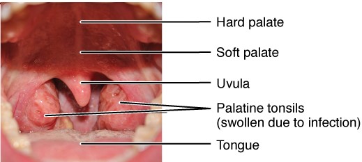 Photo showing closeup on the back of mouth and throat, with labels