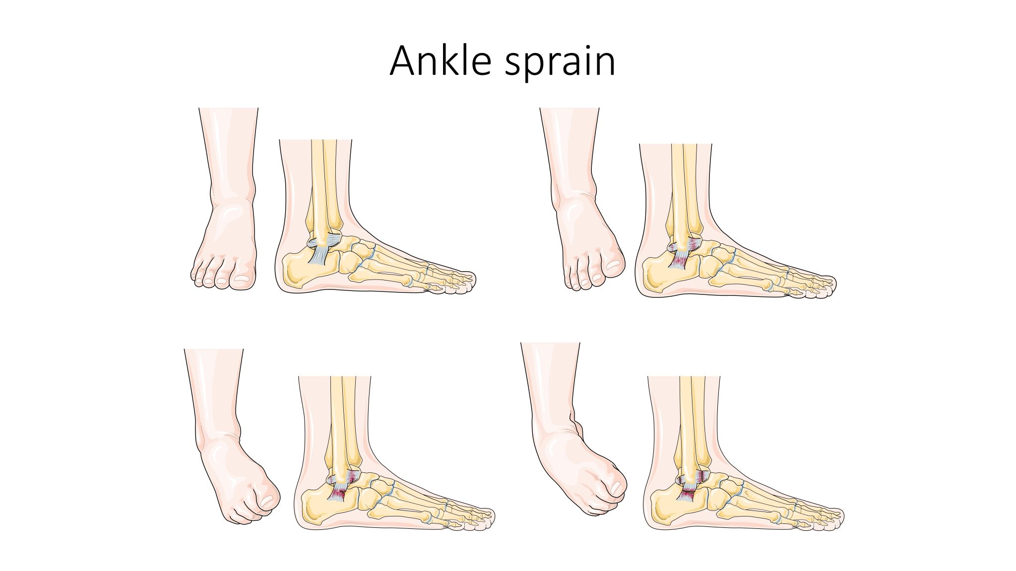 13.3 Common Musculoskeletal Conditions – Nursing Skills