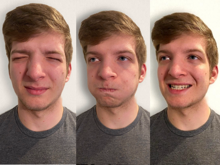 6.5 Assessing Cranial Nerves Nursing Skills