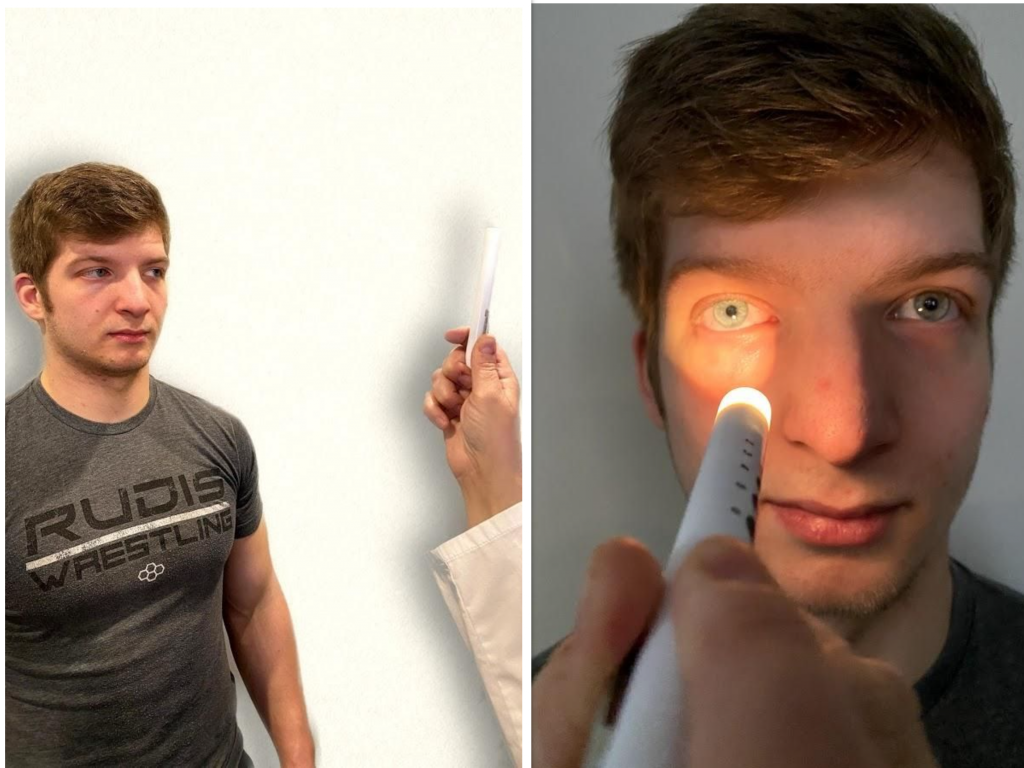 Photo showing assessment of simulated patient's pupil reaction to light source
