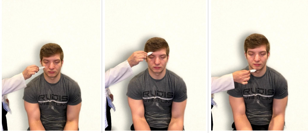 Photos of simulated patient being assessed for trigeminal sensory function