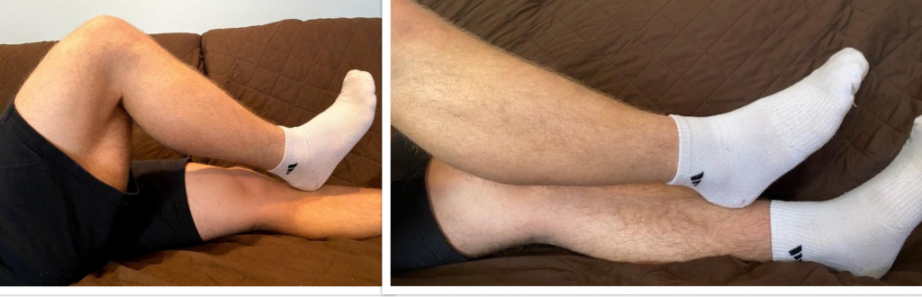 Photos showing two different positions for the heel to shin test