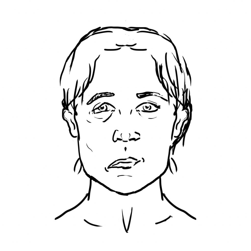 Illustration showing a person with one side of their face drooping