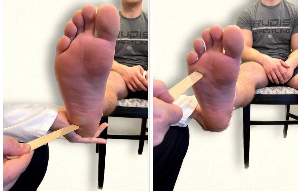 Photo showing plantar reflex in two positions