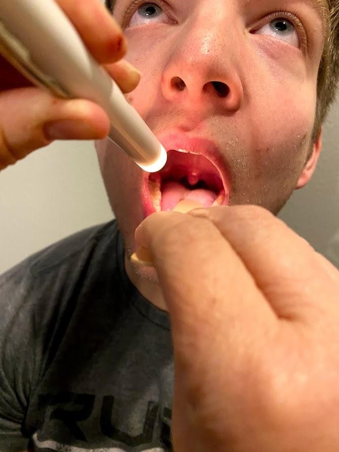 Photo showing simulated patient having mouth and throat examined