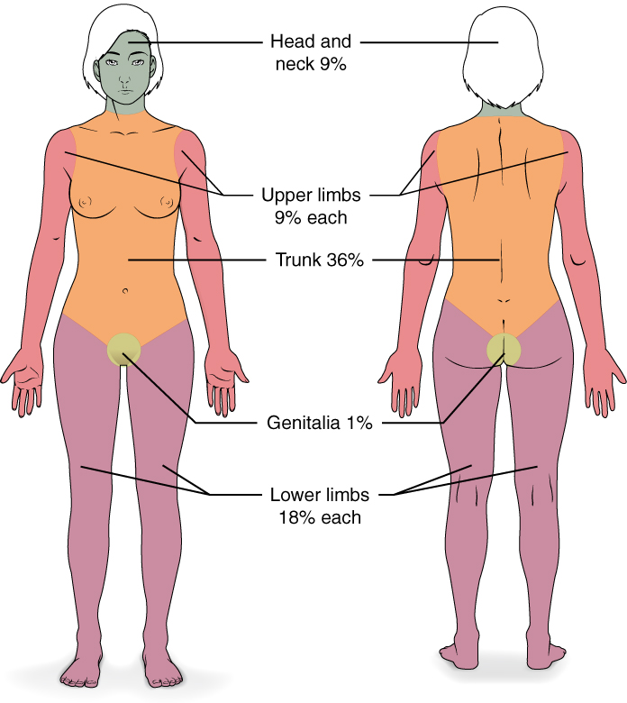 Illustration showing front and back of female figure, labeled for rule of nines for severe burn designation