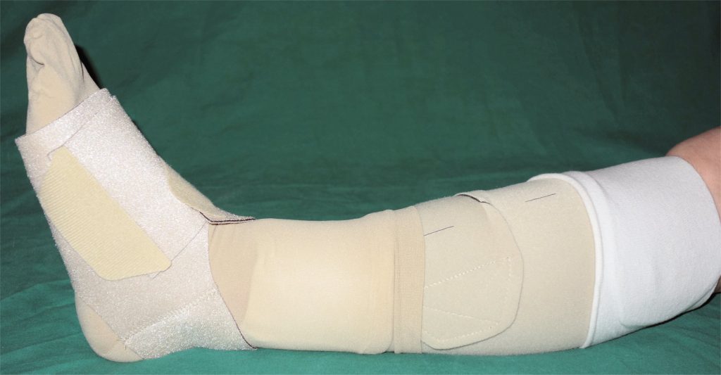 Photo showing leg wrapped in Compression Dressing for Lymphedema