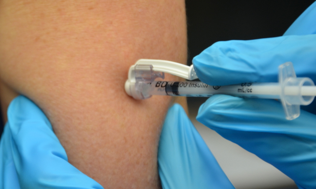 subcutaneous injection sites for injections