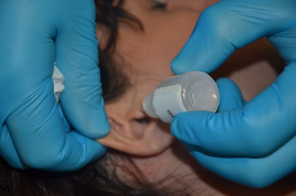 Photo showing closeup of ear drop administration