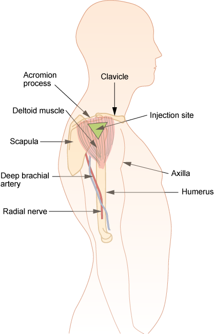 Illustration showing how to Locate the Deltoid Injection Site