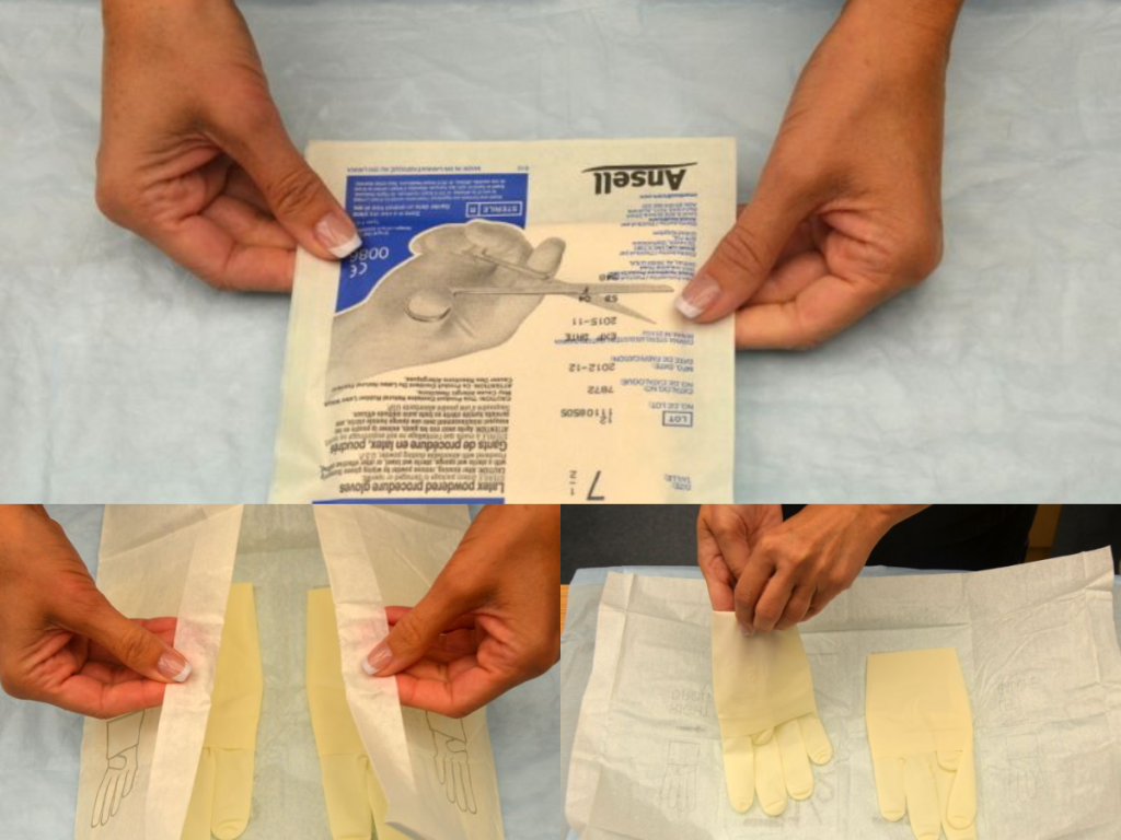 Photos showing opening of sterile gloves package