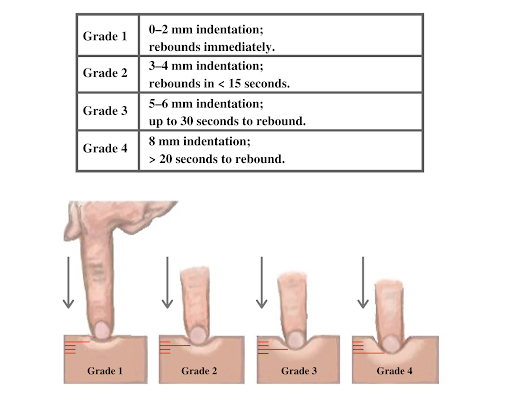 14.4 Integumentary Assessment \u2013 Nursing Skills