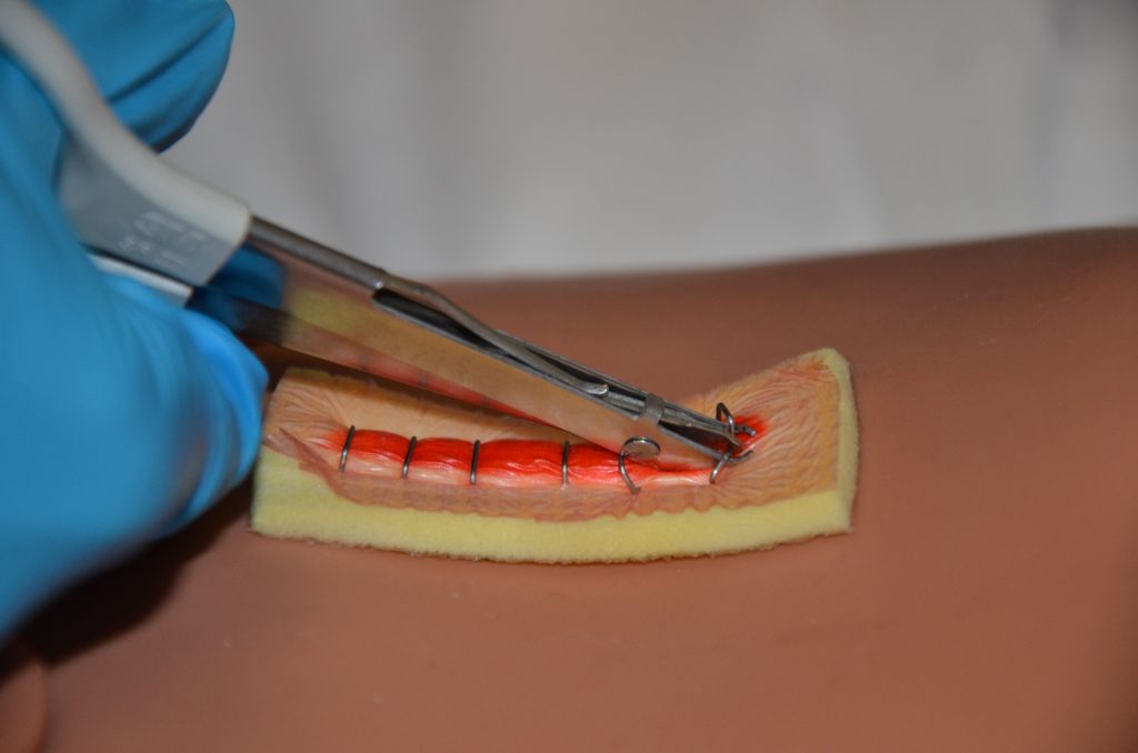 Photo showing closeup of Staple Removal from a Simulated Surgical Wound
