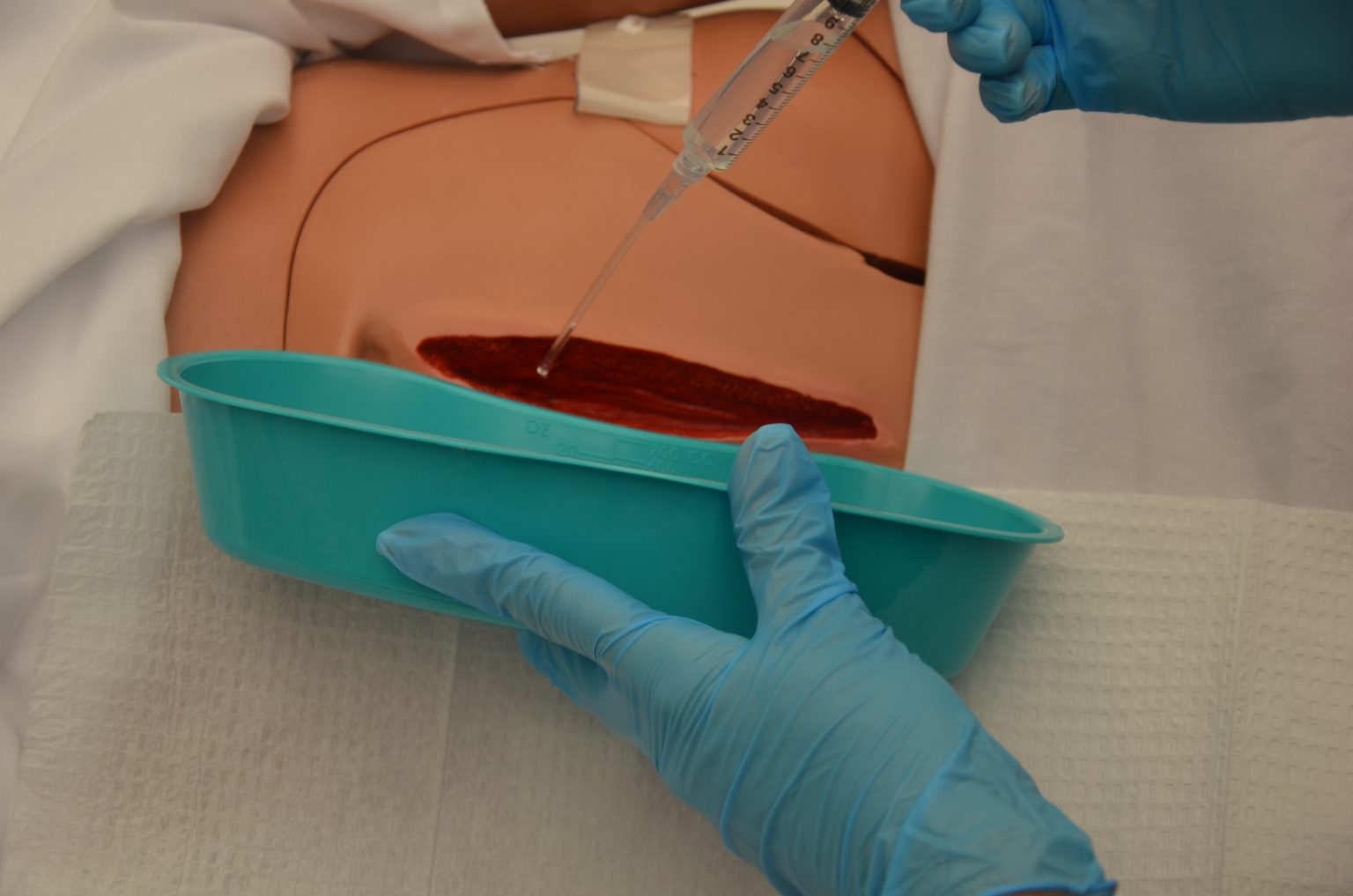 20.12 Checklist for Wound Cleansing, Irrigation, and Packing Nursing