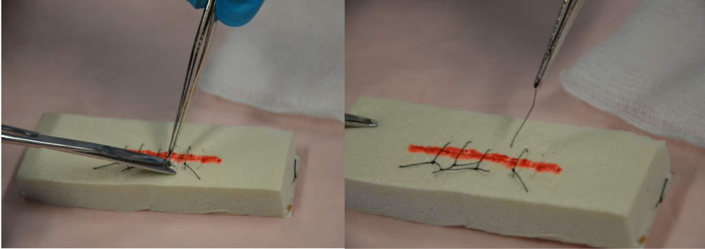 Photo showing two views of suture removal from simulated wound
