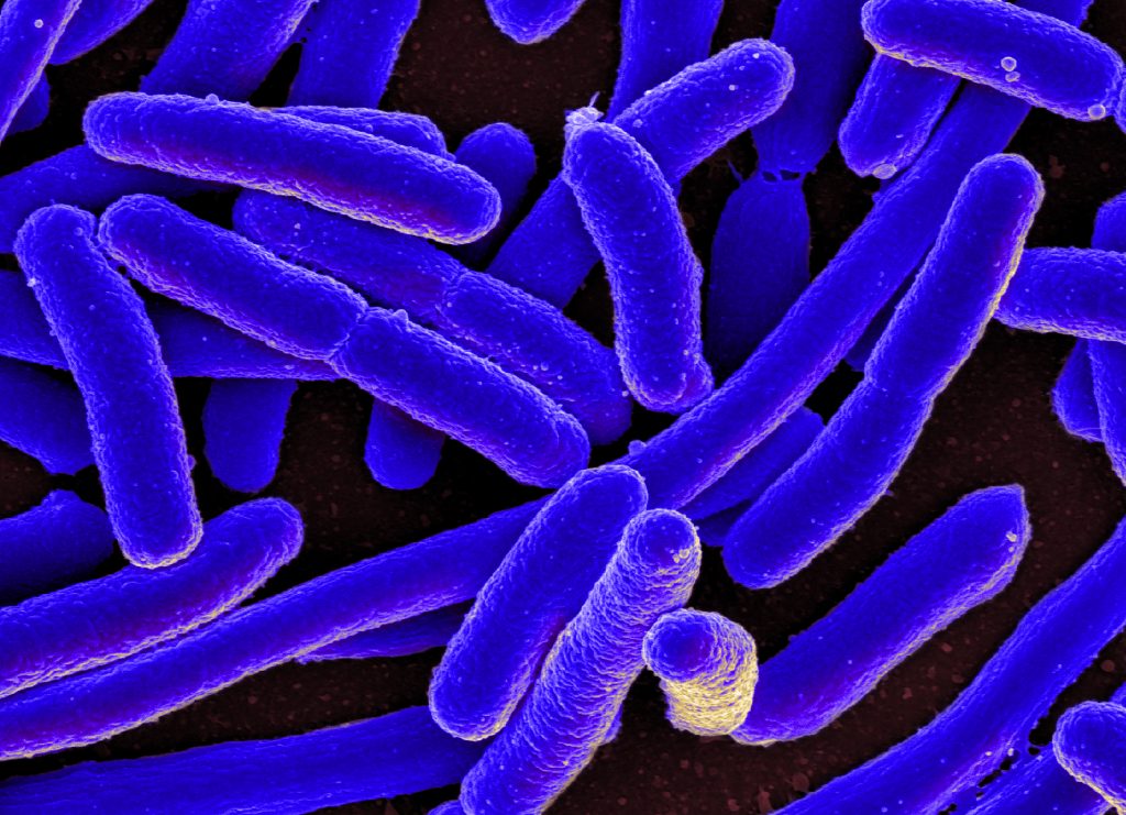 Image showing e.coli bacteria