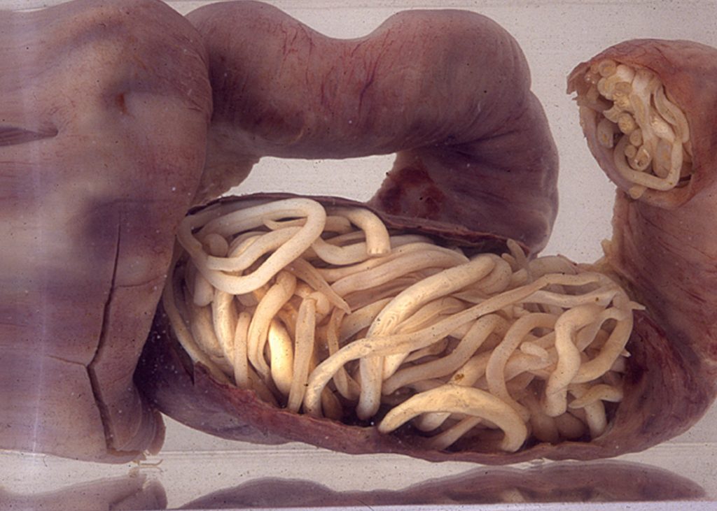 Image showing segment of intestine blocked by worms