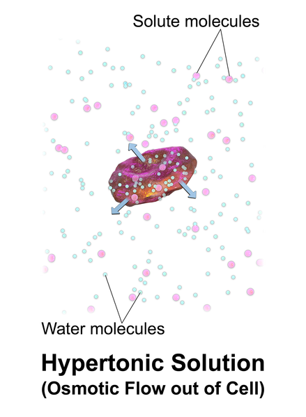 Illustration showing Hypertonic IV Solution Causing Osmotic Movement of Fluid Out of Cells