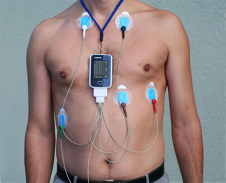 Photo showing patient on telemetry