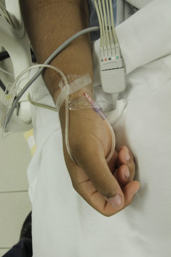 Image demonstrating arterial lines on a patient's wrist