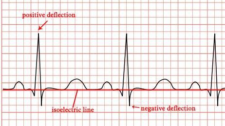 Image showing the Isoelectric Line