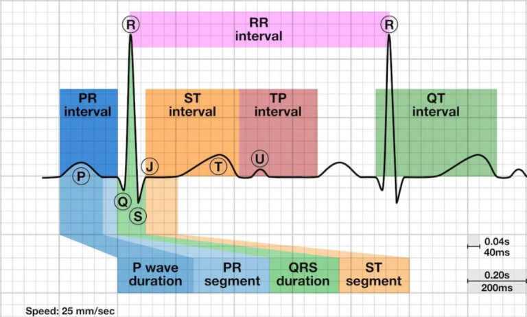 7.3 A Systematic Approach to Interpreting an ECG – Nursing Advanced Skills