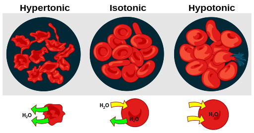 Illustration showing Comparison of Osmotic Effects of Hypertonic, Isotonic, and Hypotonic IV Fluids on Red Blood Cells