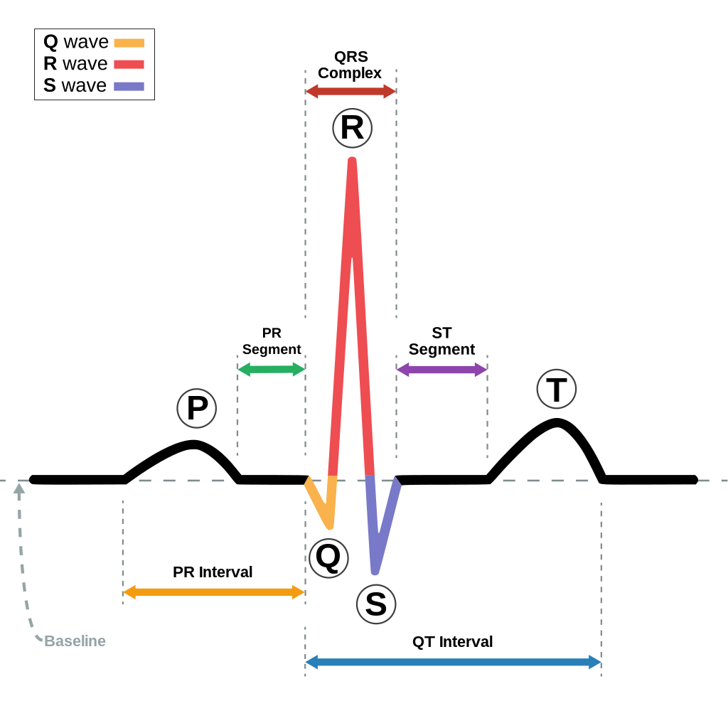 Image of Waveforms on an ECG, with textual labels