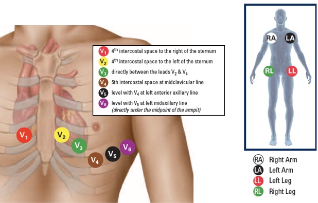 Image showing 12-Lead ECG Placement, with textual labels