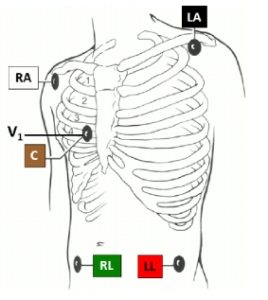 7.6 Checklist: Initiate Telemetry – Nursing Advanced Skills