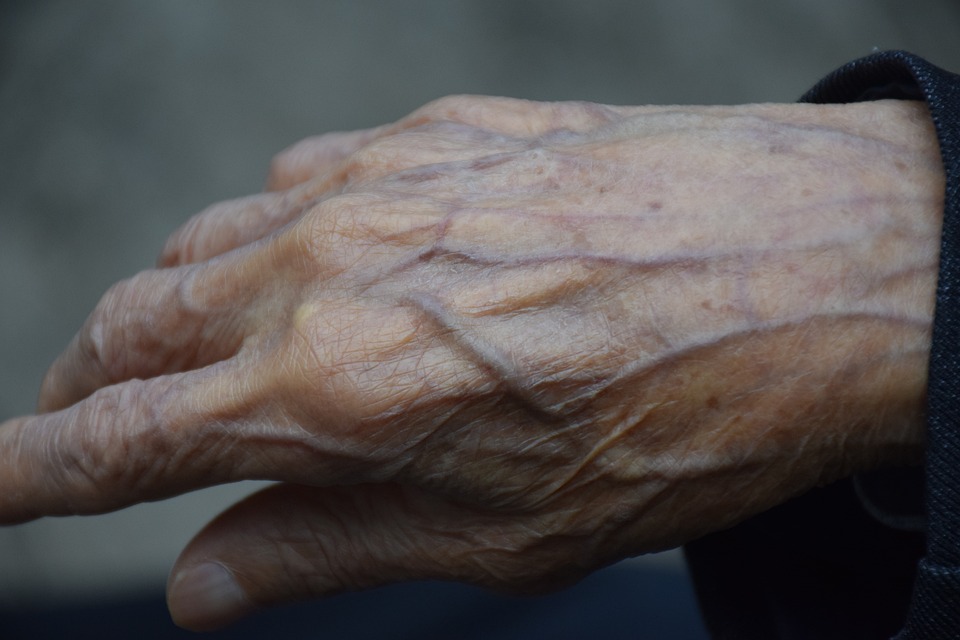 Photo showing closeup of Superficial Veins on an elderly hand